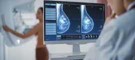 Computer,Screen,In,Hospital,Radiology,Room:,Beautiful,Multiethnic,Adult,Woman